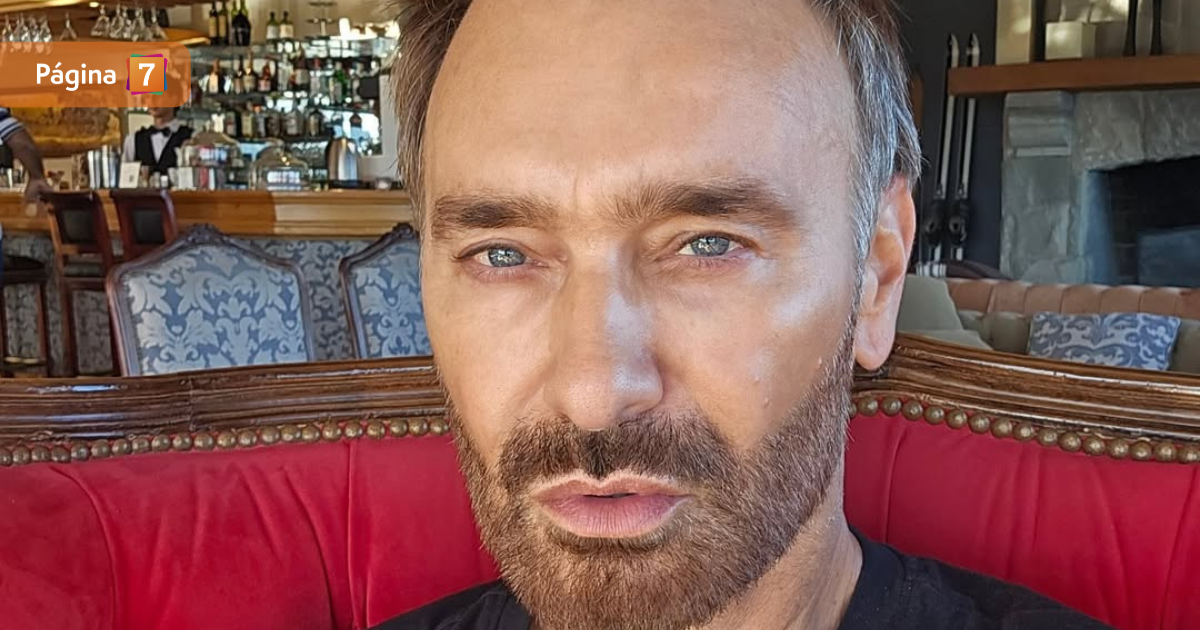 No duele, pero sí pica Jordi Castell mostró su avance tras someterse a trasplante de pelo