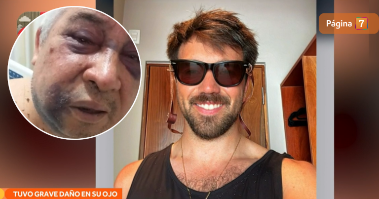 Sujeto propinó brutal golpiza a conserje de 70 años en Vitacura: le dejó fracturas en toda la cara