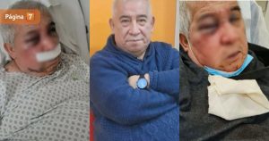 Conserje agredido en Vitacura