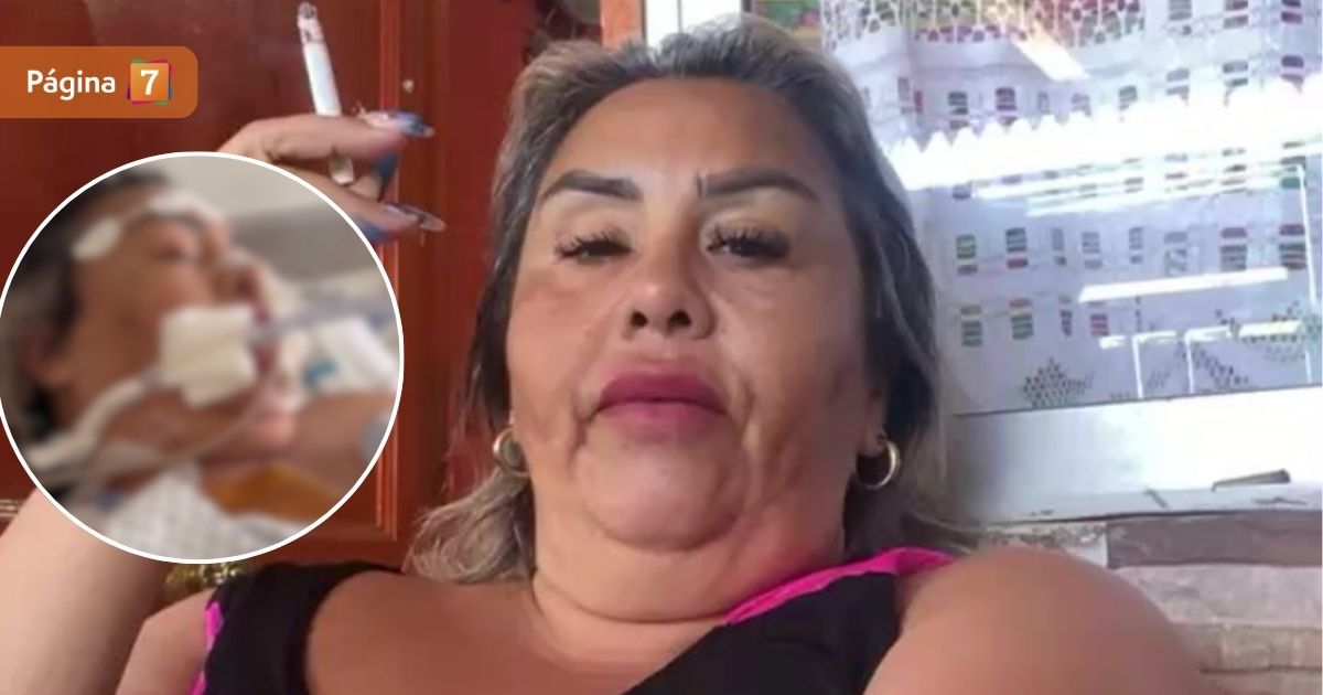 Estado de salud de Shonay