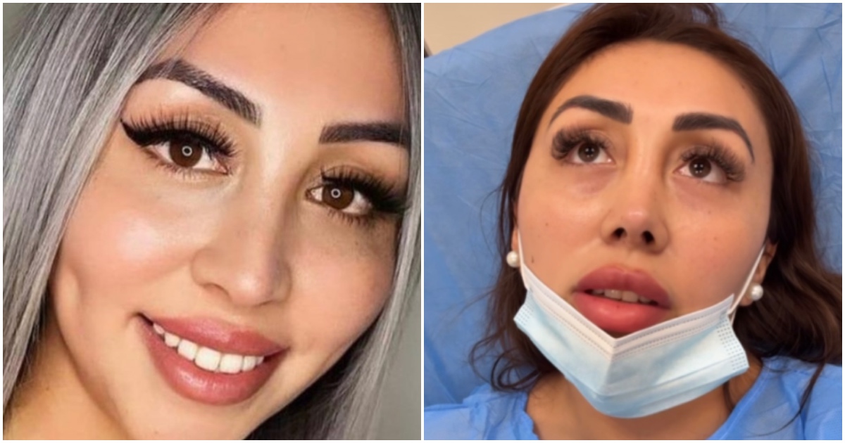 Naya Fácil sufre complicado problema de salud