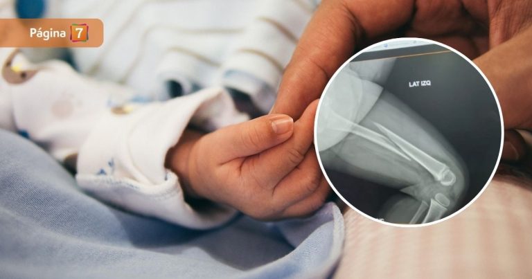 Padres acusan que su hija de 2 años sufrió fractura de fémur en jardín infantil de Padre Las Casas