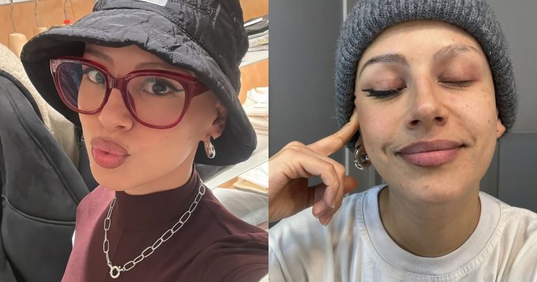 Karla Melo se atrevió a mostrar su calvicie en medio de sus quimioterapias: 