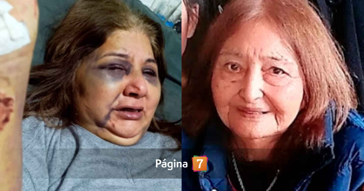 "Me arrancaba la piel": mujer de 104 años murió al defender a su hija de brutal golpiza en Argentina