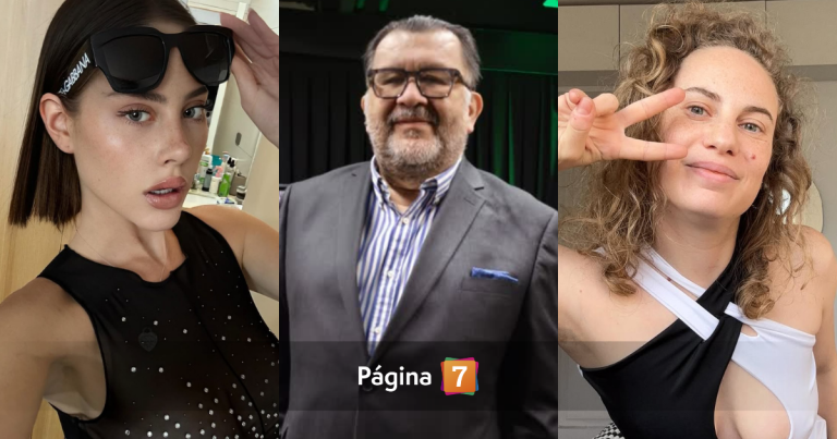 Día Internacional de la Alopecia: 8 famosos chilenos que enfrentan la silenciosa enfermedad