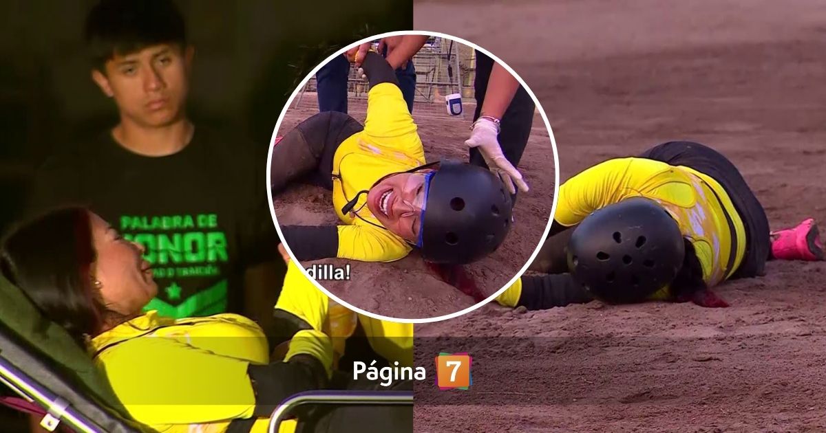 Fanny Cuevas contó detalles de su rehabilitación tras grave accidente: “No ha sido nada de fácil”