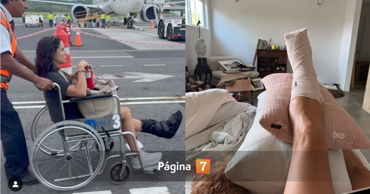 fractura leonor varela