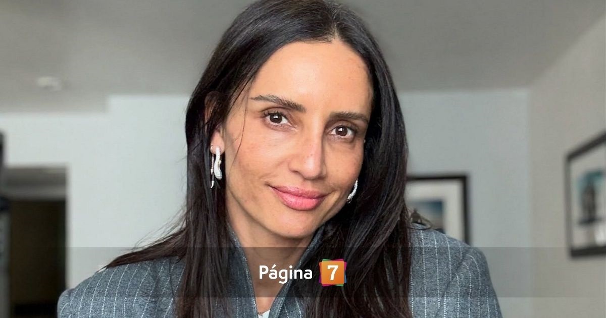 Leonor Varela sufrió accidente y quedó con triple fractura de hueso