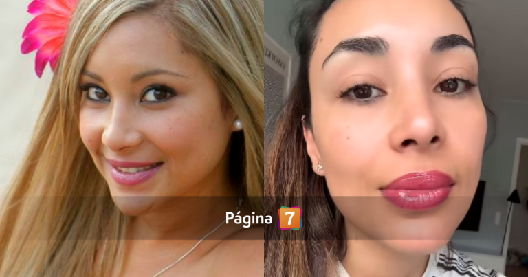 Natalia 'Arenita' Rodríguez confesó fuerte inseguridad tras retoque estético que salió mal: 