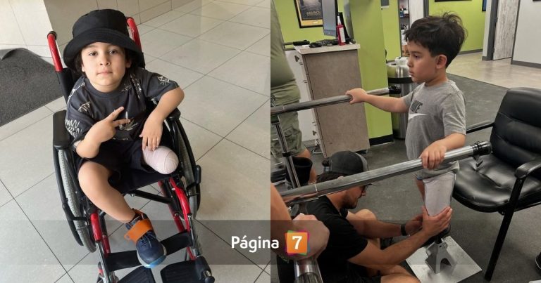 La lucha de padres de niño que terminó con su pierna amputada al ser atropellado por bus en Santiago