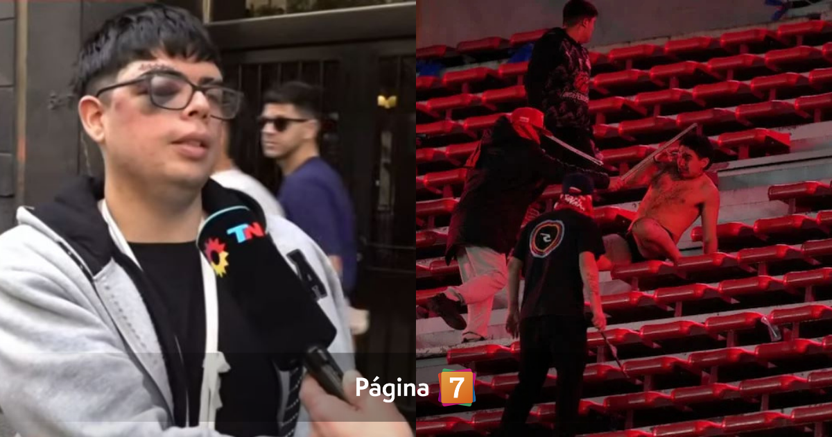 “Tengo puñaladas cerca del tórax”: hincha de la U no puede viajar a Chile por graves lesiones