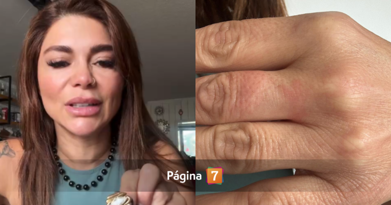 Antonella Ríos quedó con anillo atrapado en un dedo y pidió ayuda en ferretería: 