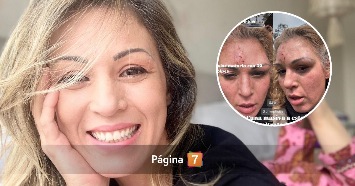 Ex Mekano, Ariela Medeiros, denunció brutal golpiza de su pareja: agresor se dio a la fuga