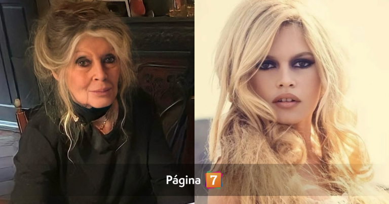 Brigitte Bardot permanece hospitalizada en Francia tras delicada cirugía por 
