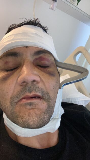 Excandidato a concejal por Santiago sufrió brutal golpiza tras intento de portonazo: “Cata quebrada”