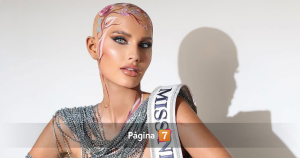 ¿Qué es la alopecia femenina? La condición de la Miss EEUU que emocionó al desfilar sin peluca