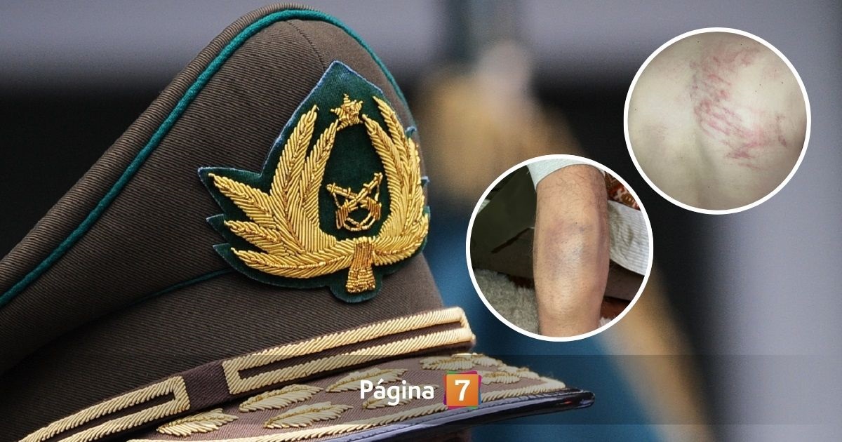 Joven con TEA denunció graves lesiones y amenazas por parte de Carabineros