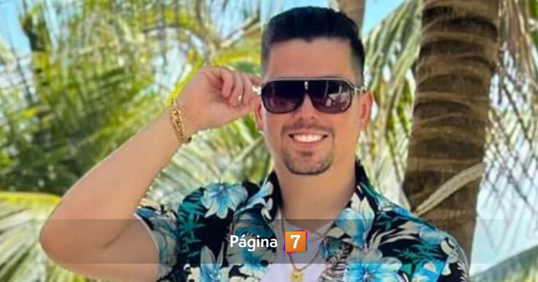 Nano Calderón presumió resultado de un popular procedimiento estético que se hizo