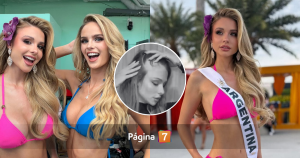 Miss Universo Argentina expuso condición física que padece tras duras críticas: 