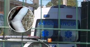 “Es lo que hay”: madre denuncia insólita atención a su hijo con fractura en SAR de Padre Las Casas