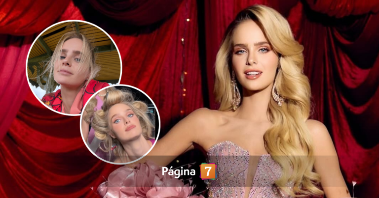 Inna Moll reveló las secuelas físicas que sufre tras su paso por el Miss Universo 2025: así luce