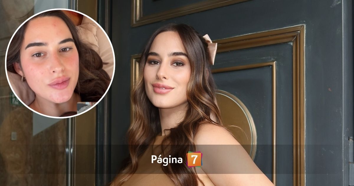 Melina Noto mostró las estrías que le dejó el embarazo: reveló qué está haciendo para eliminarlas