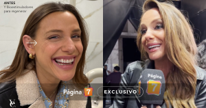 Emilia Daiber explicó su motivación para hacerse un retoque en el rostro: 