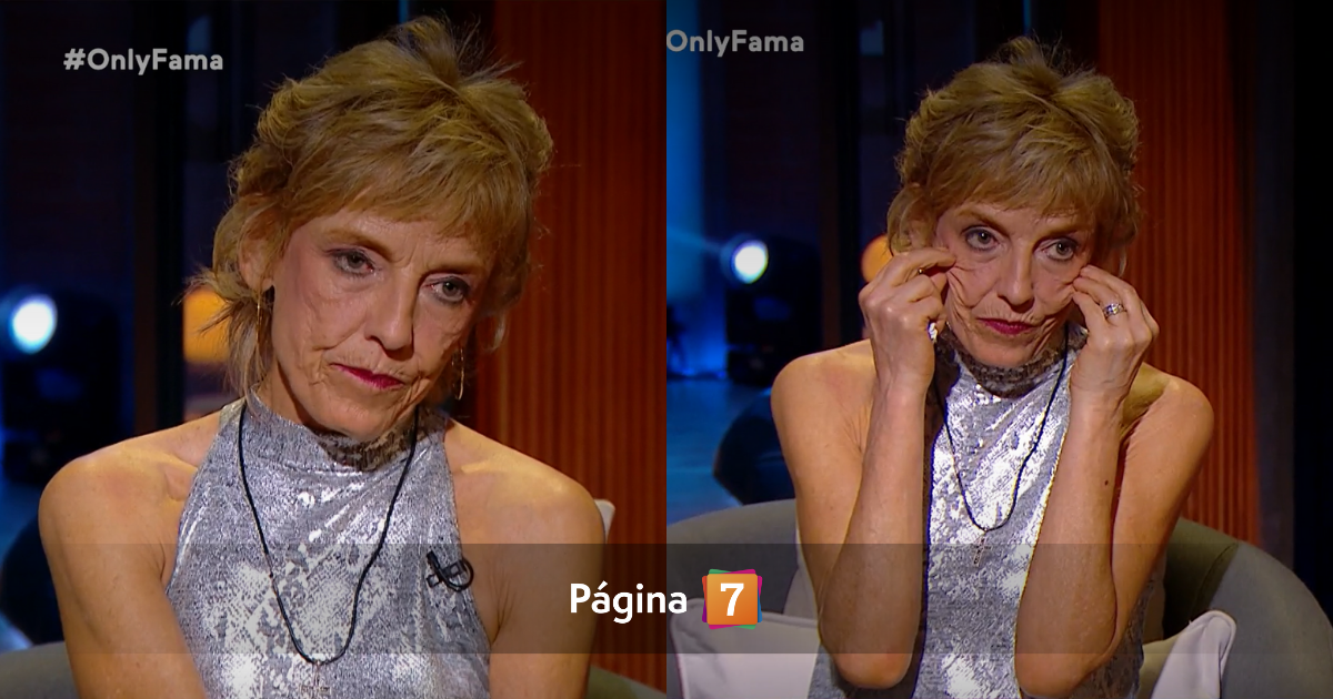 Adriana Vacarezza revela el problema mandibular que le complica al hablar