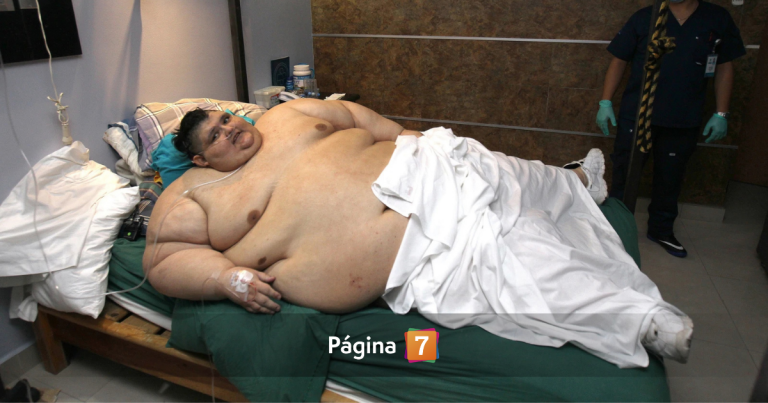 Fallece Juan Pedro Franco, el mexicano que llegó a pesar casi 600 kilos