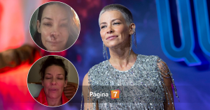 Evangeline Lilly, actriz de Lost y Ant-Man, impacta al revelar que tiene daño cerebral