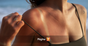 Verano y piel al límite: los problemas estéticos que más aumentan con el sol y cómo prevenirlos