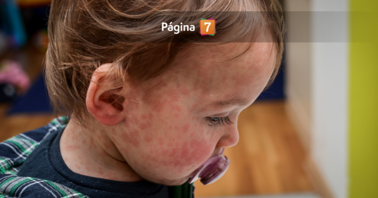 No solo niños en riesgo: quiénes deben vacunarse contra el sarampión tras segundo caso confirmado