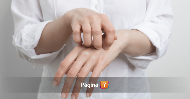 Brote en Hospital Regional de Antofagasta: qué es la sarna Noruega y cómo se contagia