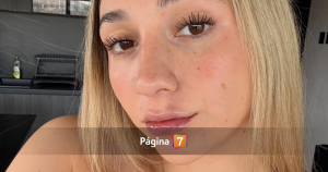 Carlita Inostroza lució un bikini a dos meses de su cirugía estética