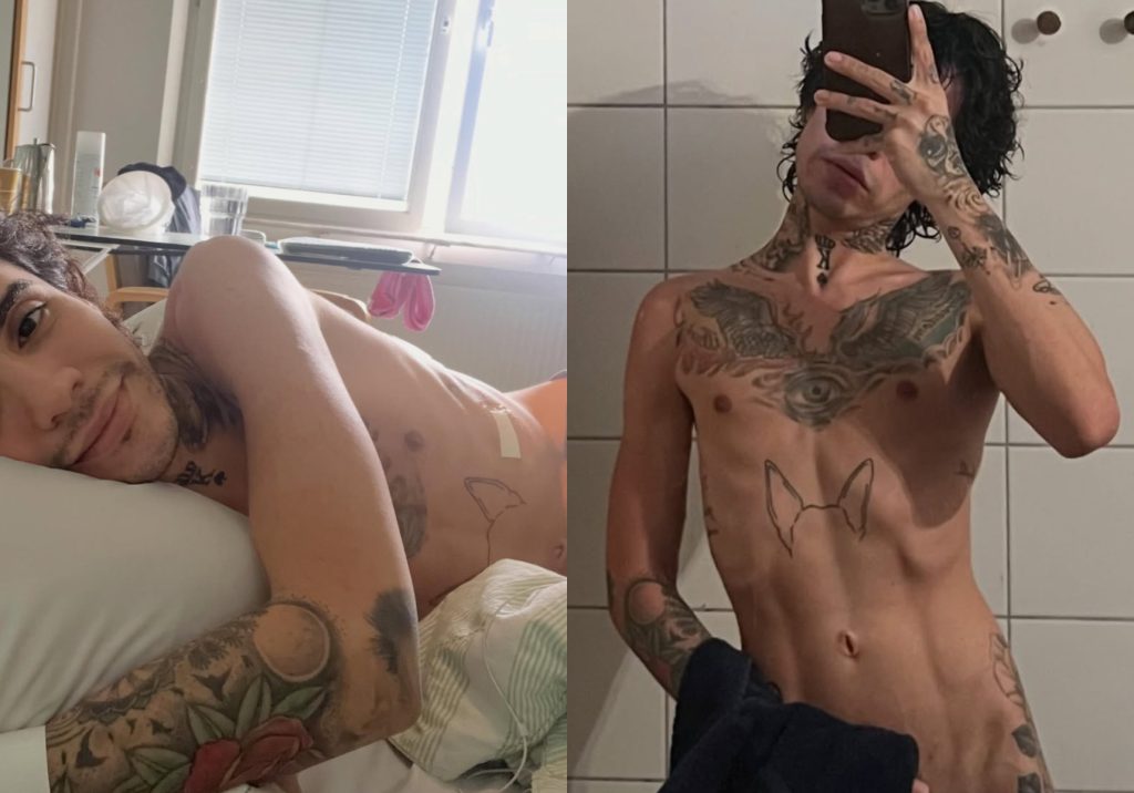 Leo Méndez Jr. sorprendió con cambio físico tras superar cuadro de anorexia nerviosa: