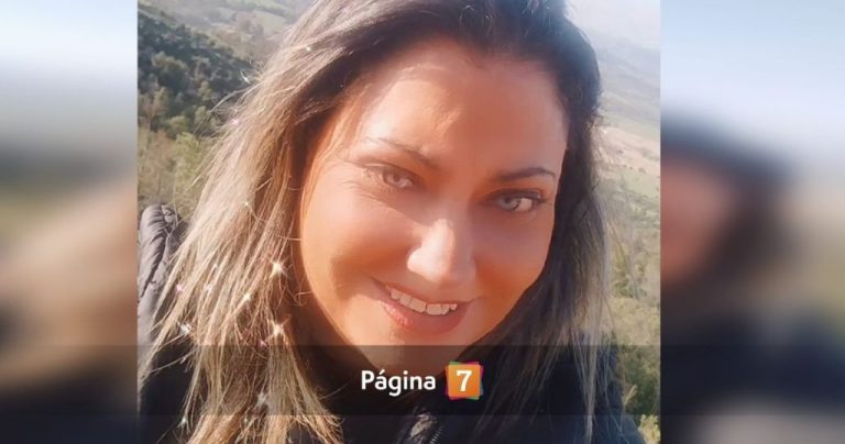 Denisse Campos comparte video tras cirugía y deja ola de reacciones: “Te sacaste 10 años”