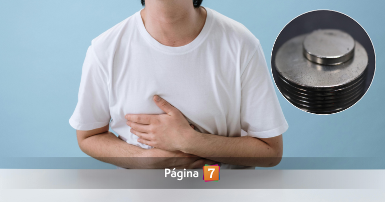 El peligroso reto con imanes que se ha vuelto viral: pediatra advirtió 