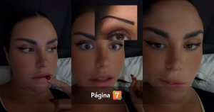 Emilia Dides reveló retoque en su rostro tras críticas: 