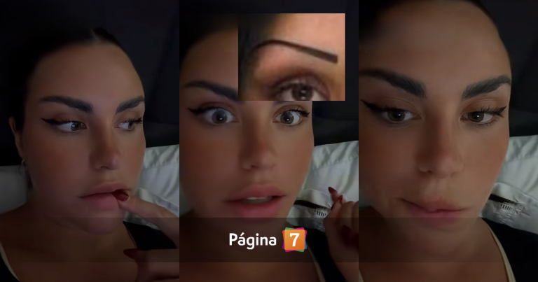 Emilia Dides reveló retoque en su rostro tras críticas: 