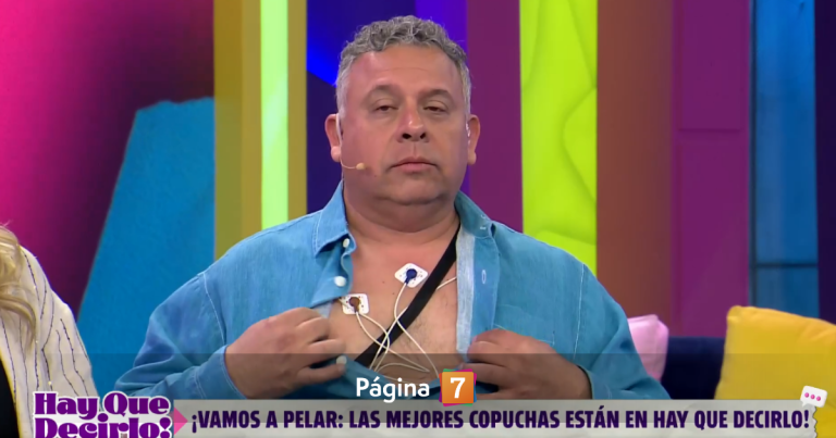 Willy Sabor preocupó al aparecer con un aparato médico para el corazón en TV: ¿qué le pasó?