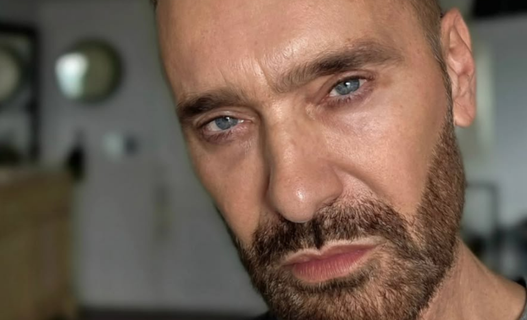 Jordi Castell mostró resultados de implante de cabello: 