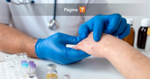 ¿Cómo detectar el lupus? Los síntomas que muchas veces pasan desapercibidos