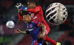 Eduardo Vargas reveló impactante fractura tras fuerte choque con arquero rival: 