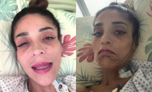 Tras días en riesgo vital y salir de la UCI: Kathy Orellana impactó con radical cambio de look
