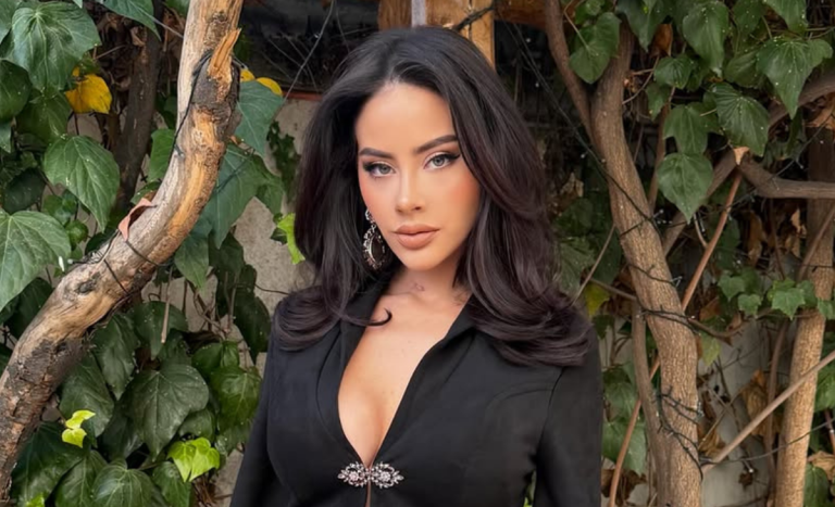 Nacha Michelson estrenó look y reveló padecimiento: 