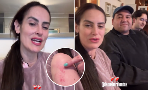 Adriana Barrientos agradece muestras de cariño tras sufrir portonazo y actualiza su estado de salud