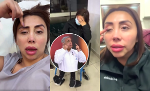 ¿Qué es la blefaroptosis? La particular afección que terminó con Naya Fácil en urgencias