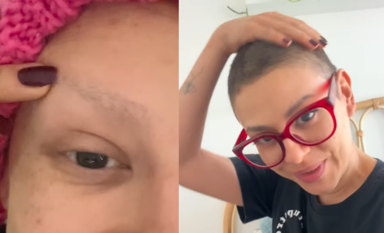 Karla Melo mostró cómo cambió su pelo a un año de su última quimio: 