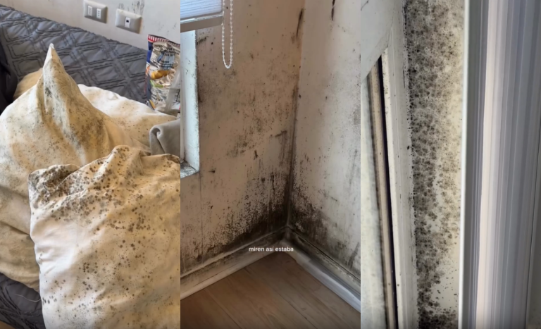 Joven mostró invasión de hongos en departamento de Concepción: 