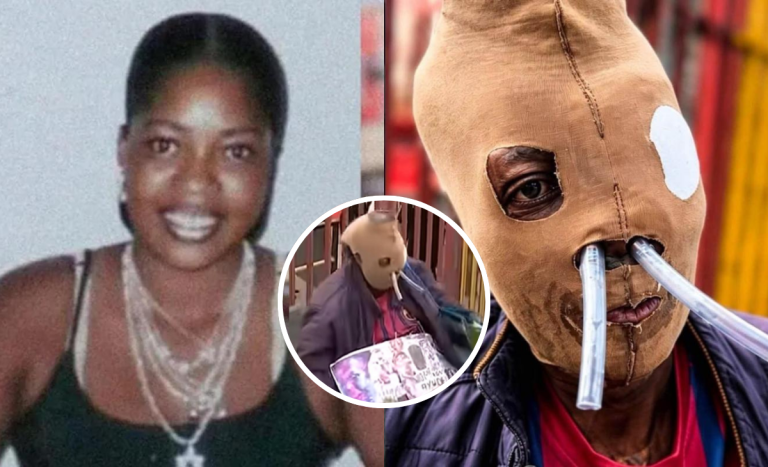 La historia de María Córdoba, mujer que fue atacada con ácido por su esposo: ahora pide su eutanasia